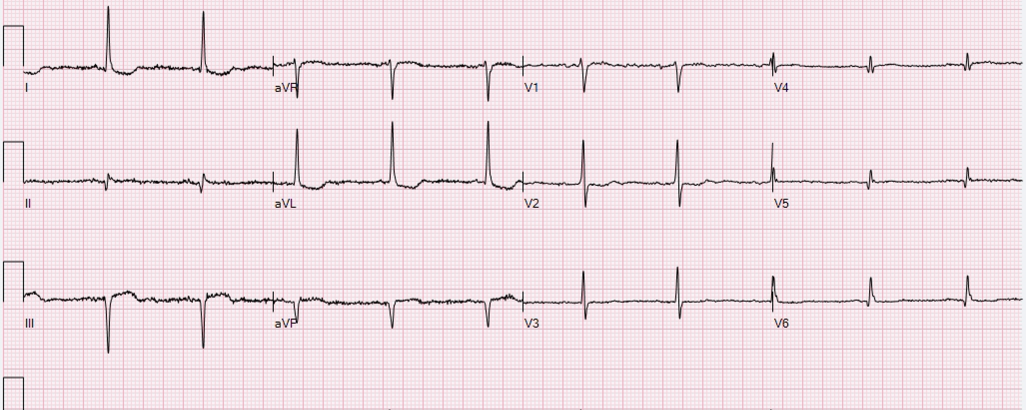 Patient op de afdeling