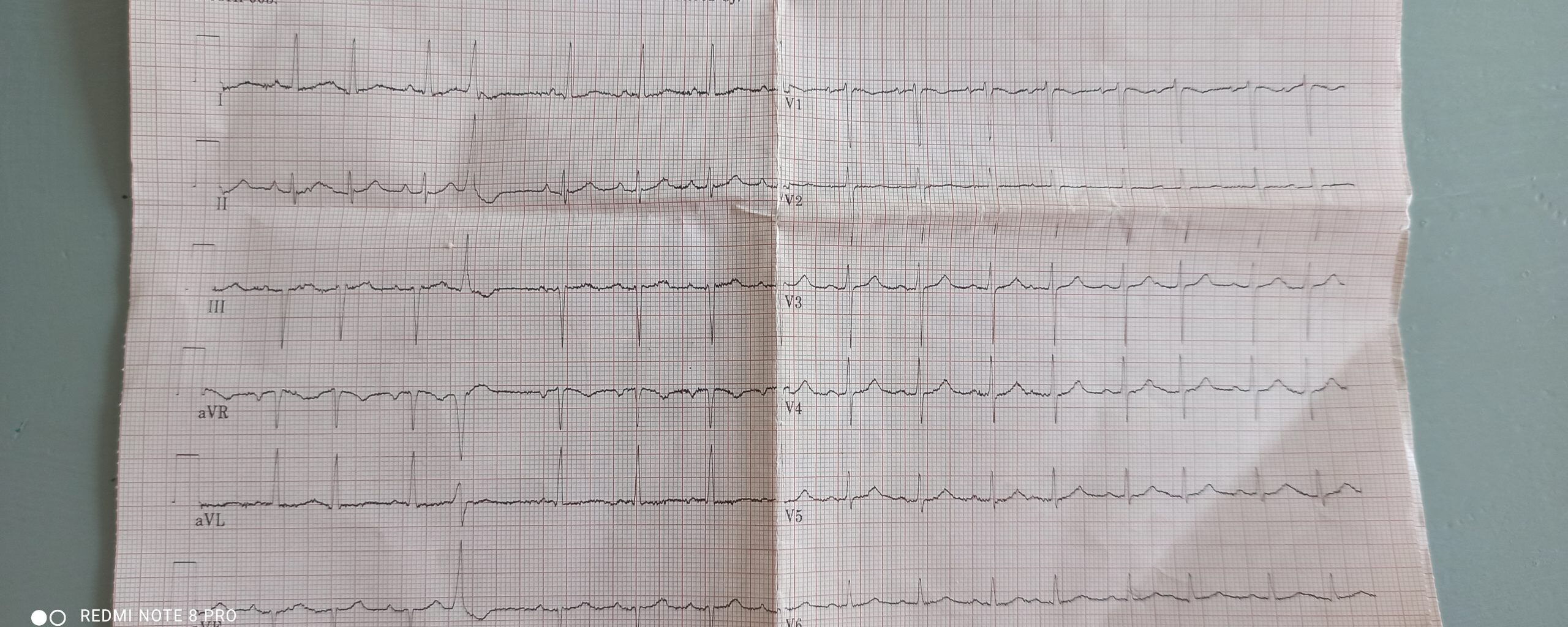 F.08HF005
