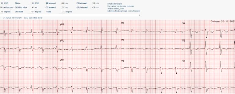 Is er een cardiale verklaring voor algehele malaise?